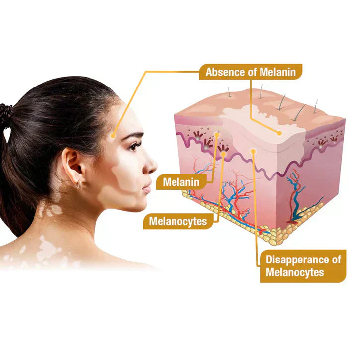 VitiGO™ Bee Venom Cream – Skin Repair & Glow